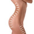 Fat Reduction and Body Contouring: Achieving Your Desired Body Shape Without Surgery