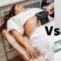 Cool Sculpting vs Laser Fat Removal: Which is the Best Option for Stubborn Fat?