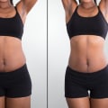 Liposuction: Understanding Cool Sculpting and Other Non-Surgical Options