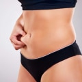 Does fat come back after coolsculpting?