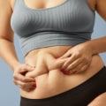 Preparing for Cool Sculpting: A Comprehensive Guide to Reducing Stubborn Fat