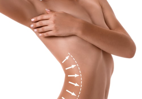 Fat Reduction and Body Contouring: Achieving Your Desired Body Shape Without Surgery