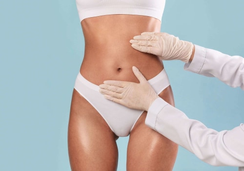 Everything You Need to Know About Cool Sculpting