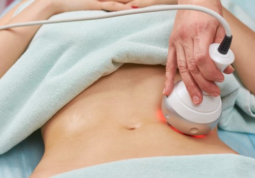 Understanding Radiofrequency Treatments for Non-Surgical Body Contouring