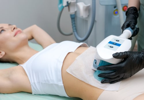 What is the downside of coolsculpting?