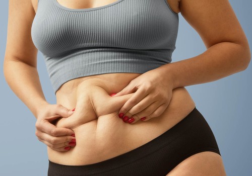 Preparing for Cool Sculpting: A Comprehensive Guide to Reducing Stubborn Fat